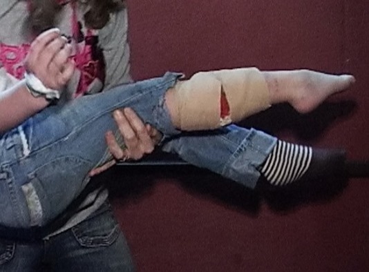 fata-muscata-de-caini