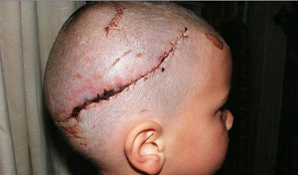 victima-copil-muscat-de-caini